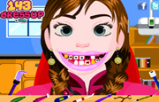 Juego Dentista Princesa Anna